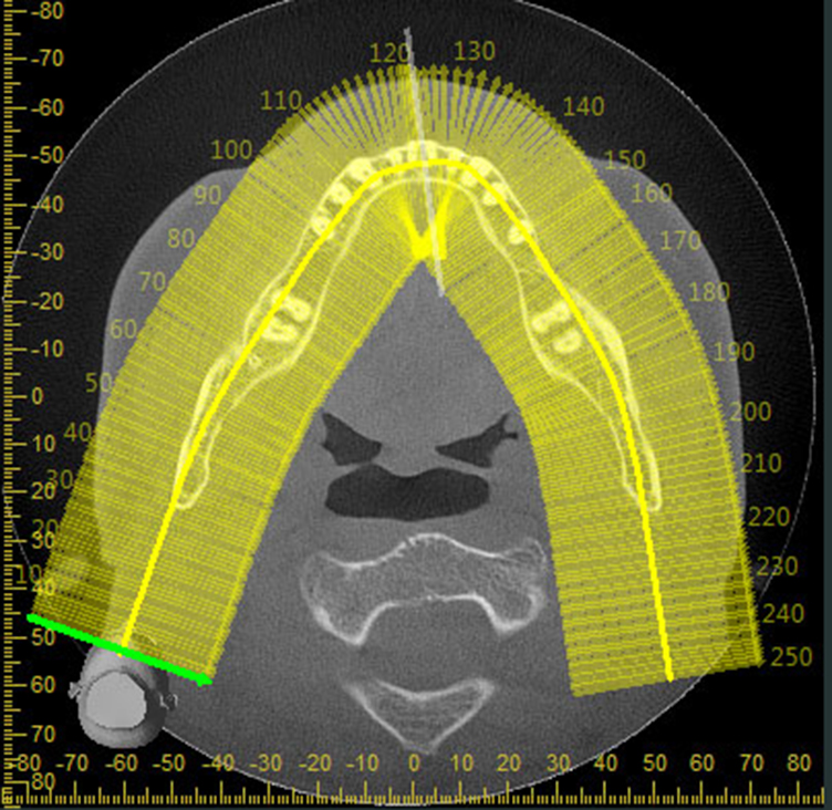 Implant Dentistry